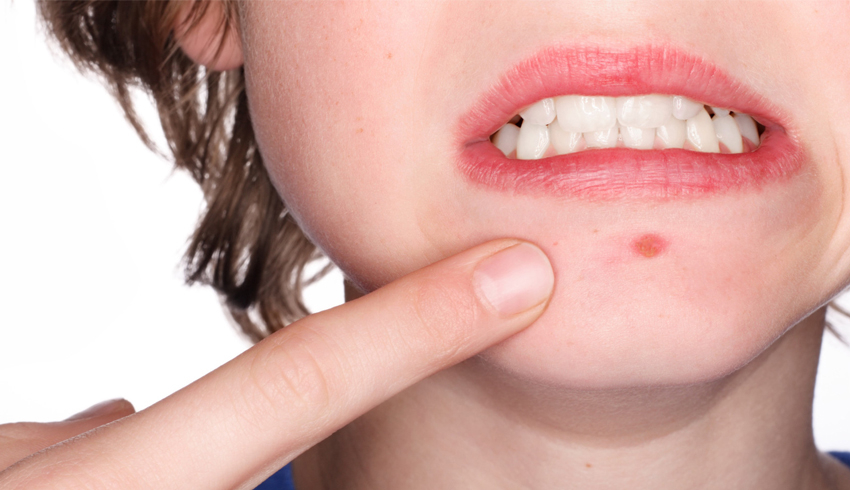 4 Dos & Don’ts For Problem Skin